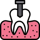 Free Implante Dental Corona Caries Icono