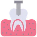 Free Implante Dentario Coroa Carie Dentaria Ícone