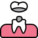 Veneers Material Layer Teeth Crown Icon