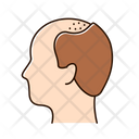 Alopecia Icon