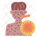 Chicken Pox Icon