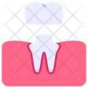 Dental Crown Treatment Icon