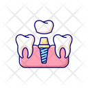 Dental implants procedure Icon