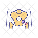 Hip Replacement Icon