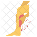 Leg Fractured Leg Pain Leg Bleeding Icon