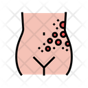 Lichen Shingles Disease Icon