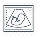 초음파 배아 초음파 검사 아이콘