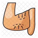 上腕形成術  アイコン