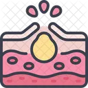 Acne Pimple Skin Icon