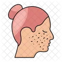 Acne treatment  Icon