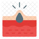 Akne  Symbol