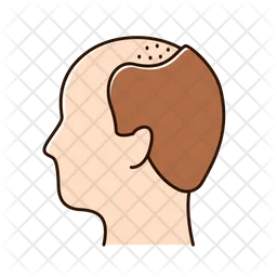 Alopecia  Icon