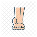 Ankle inflammation  Icon