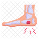 Ankle Injury  Icon