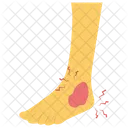 Ankle Injury  Icon