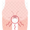 Anus Pain Hemorrhoids Icon
