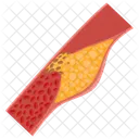 Artere Bouchee Maladie Arterielle Artere Icône