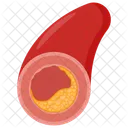 Atherosclerosis Fats Plaque Icon