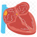 Atrial fibrillation  Icon