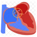 Atrial septal defect  Icon