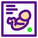 Baby Diagram  Icon