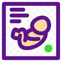 Baby-Diagramm  Symbol