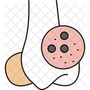Black Heads Acne Treatment Pore Cleansing Icon