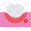Bleeding gums  Icon