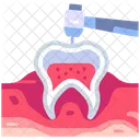 Bohren  Symbol