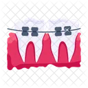 Braces  Icon