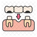 Bridge Implant Dentist Icon
