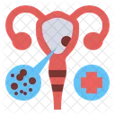 Cáncer de cuello uterino  Icono