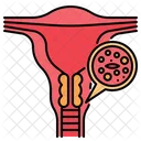 Cáncer de cuello uterino  Icono