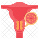 Cáncer de cuello uterino  Icono