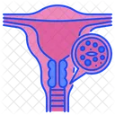 Cáncer de cuello uterino  Icono