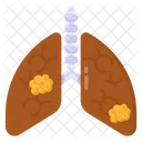 Enfermedad Pulmonar Cancer De Pulmon Adenocarcinoma Icon