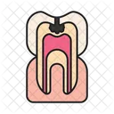 Caries Cavity Decay Icon