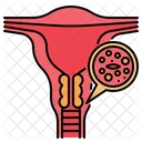 Cervical cancer  Icon