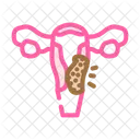 Cervical Cancer Woman Icon