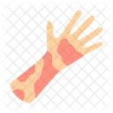 Contact Dermatitis  アイコン