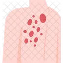 Herpes Zoster Ampolla Piel Icono