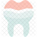 Dental Onlays Restoration Icon