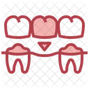Dental Bridge  Icon