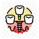 Dental Implant  Icon