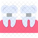 Dental Implant Dental Gum Icon