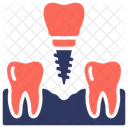 Dental Implant Tooth Replacement Icon