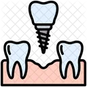 Dental Implant Tooth Replacement Icon