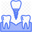 Dental Implant Tooth Replacement Icon