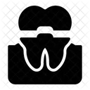 Dental Implant  Icon