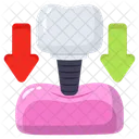 Dental Implant Placement Icon